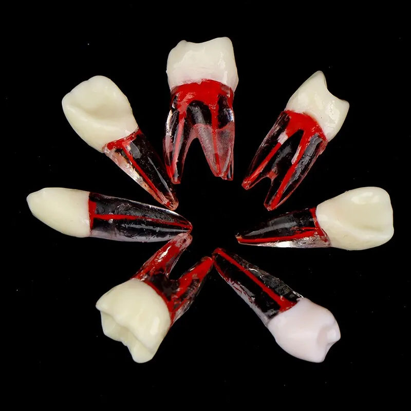 1PCS Dental Endodontic Tooth Model With Colored Root Canal And Pulp Model For Student Study Practice