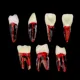 1PCS-Dental-Endodontic-Tooth-Model-With-Colored-Root-Canal-And-Pulp-Model-For-Student-Study-Practice6J9y1IG8.webp