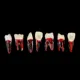 1PCS-Dental-Endodontic-Tooth-Model-With-Colored-Root-Canal-And-Pulp-Model-For-Student-Study-Practice6gN48UIB.webp