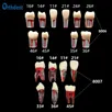 ining-Block-Tooth-Endodontics-Root-Canal-Model-Dentistry-RCT-Students-Practice-Medullary-Pulp-CavityeDV78xsL.webp